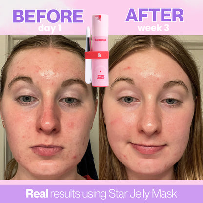 Star Jelly 10% Aha Exfoliating Mask