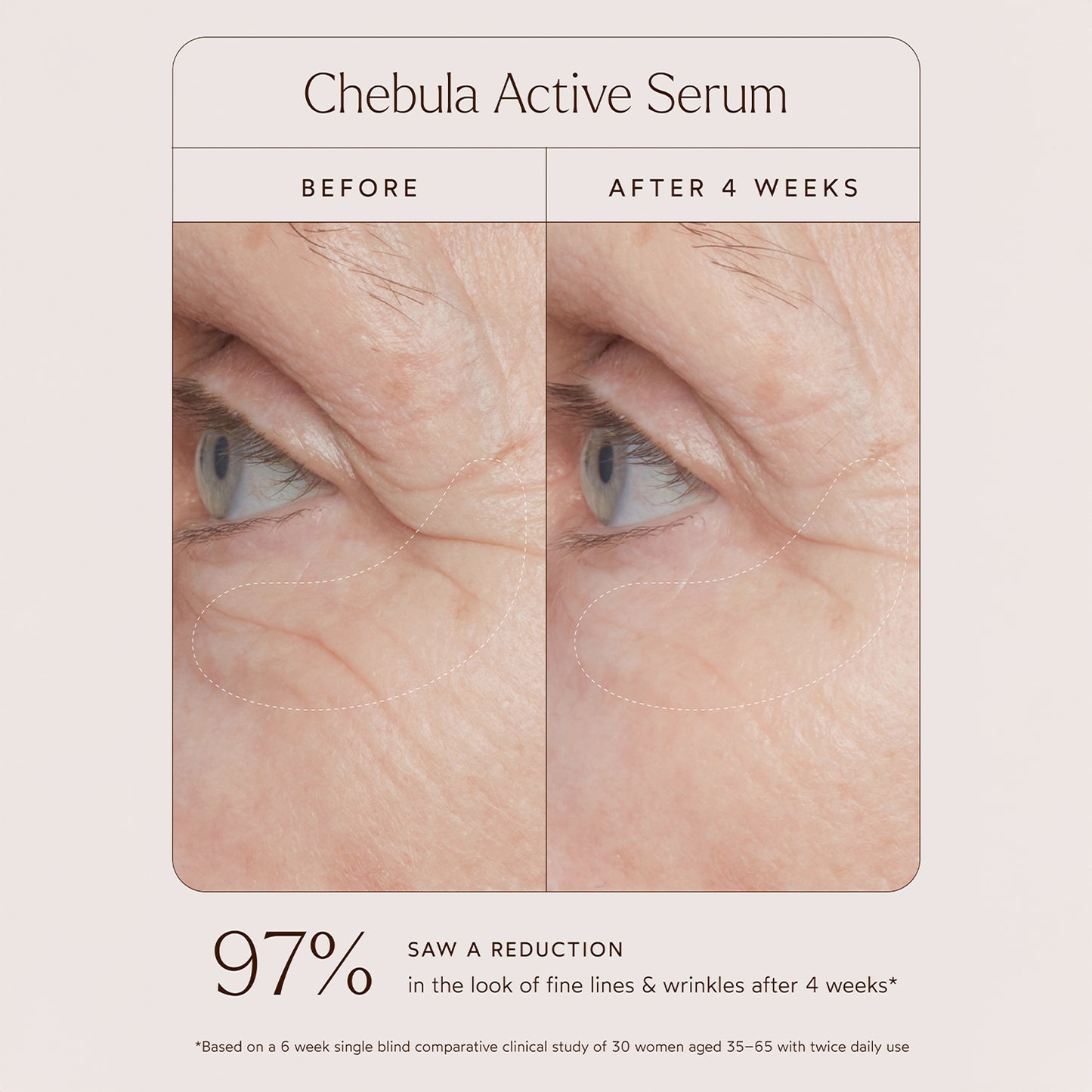 Chebula Active Serum