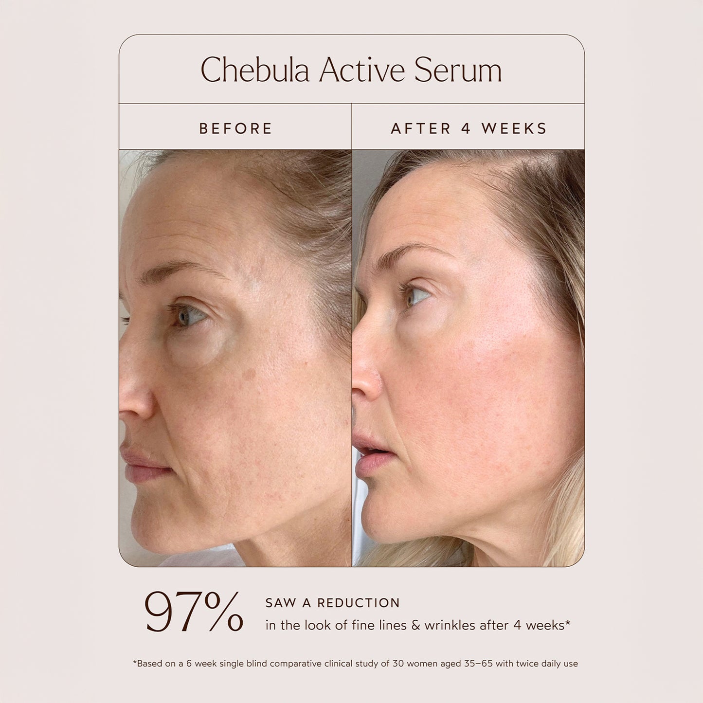 Chebula Active Serum