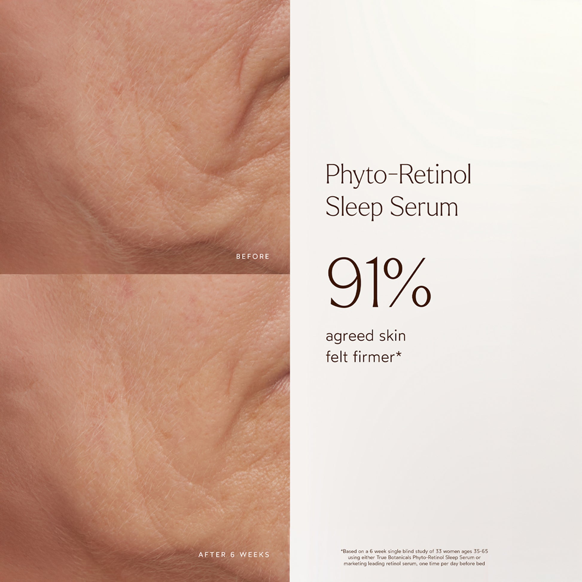 Phyto-Retinol Sleep Serum