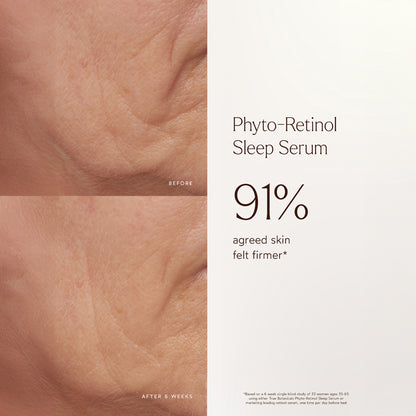 Phyto-Retinol Sleep Serum