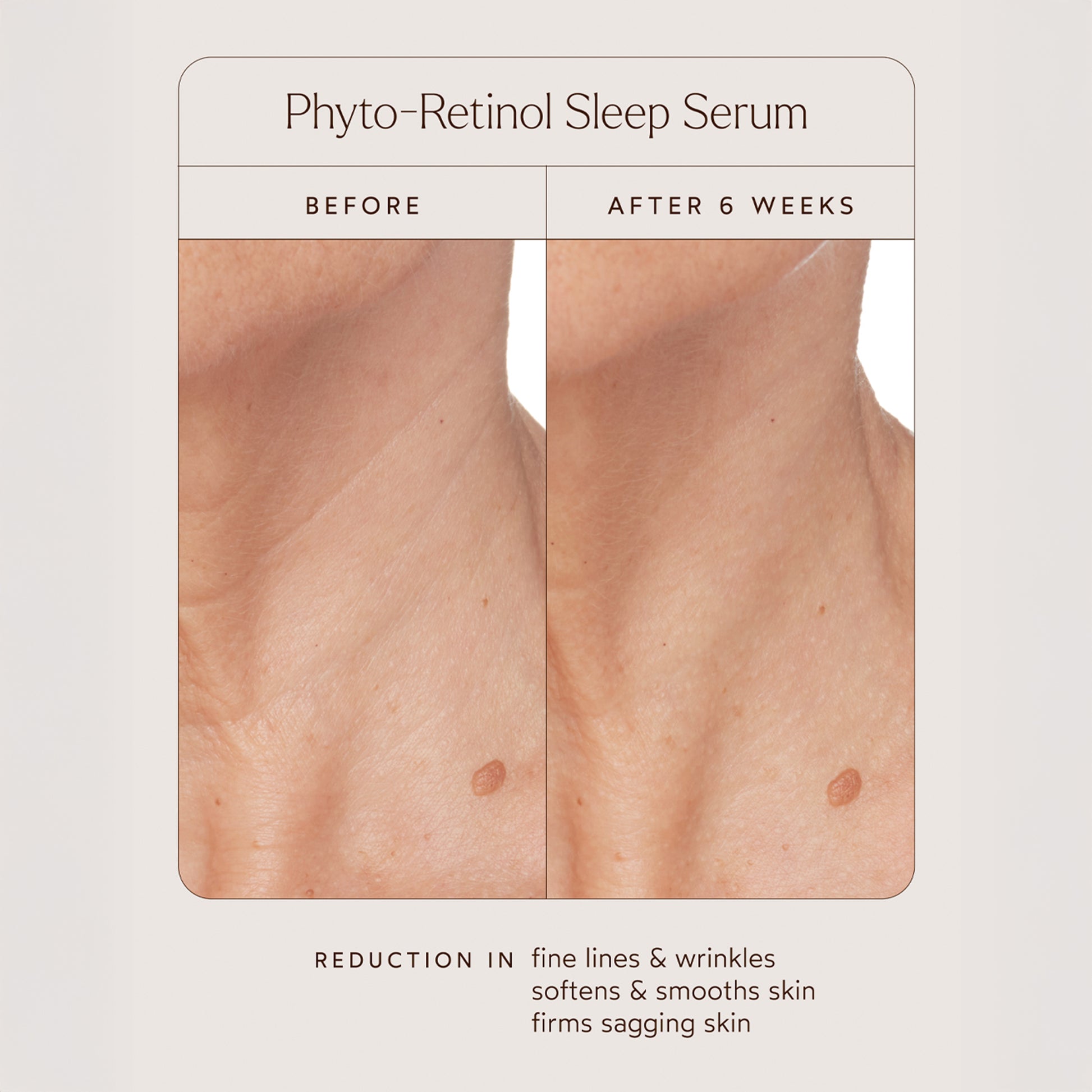 Phyto-Retinol Sleep Serum