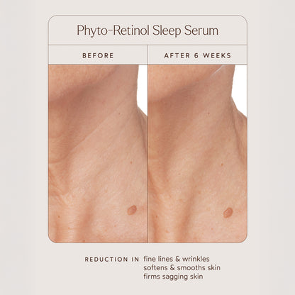 Phyto-Retinol Sleep Serum