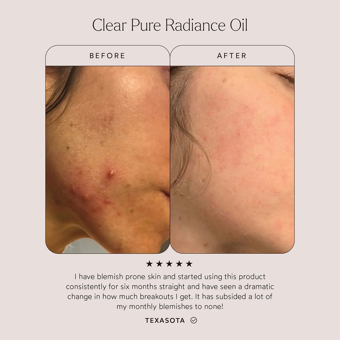 Clear Pure Radiance Oil