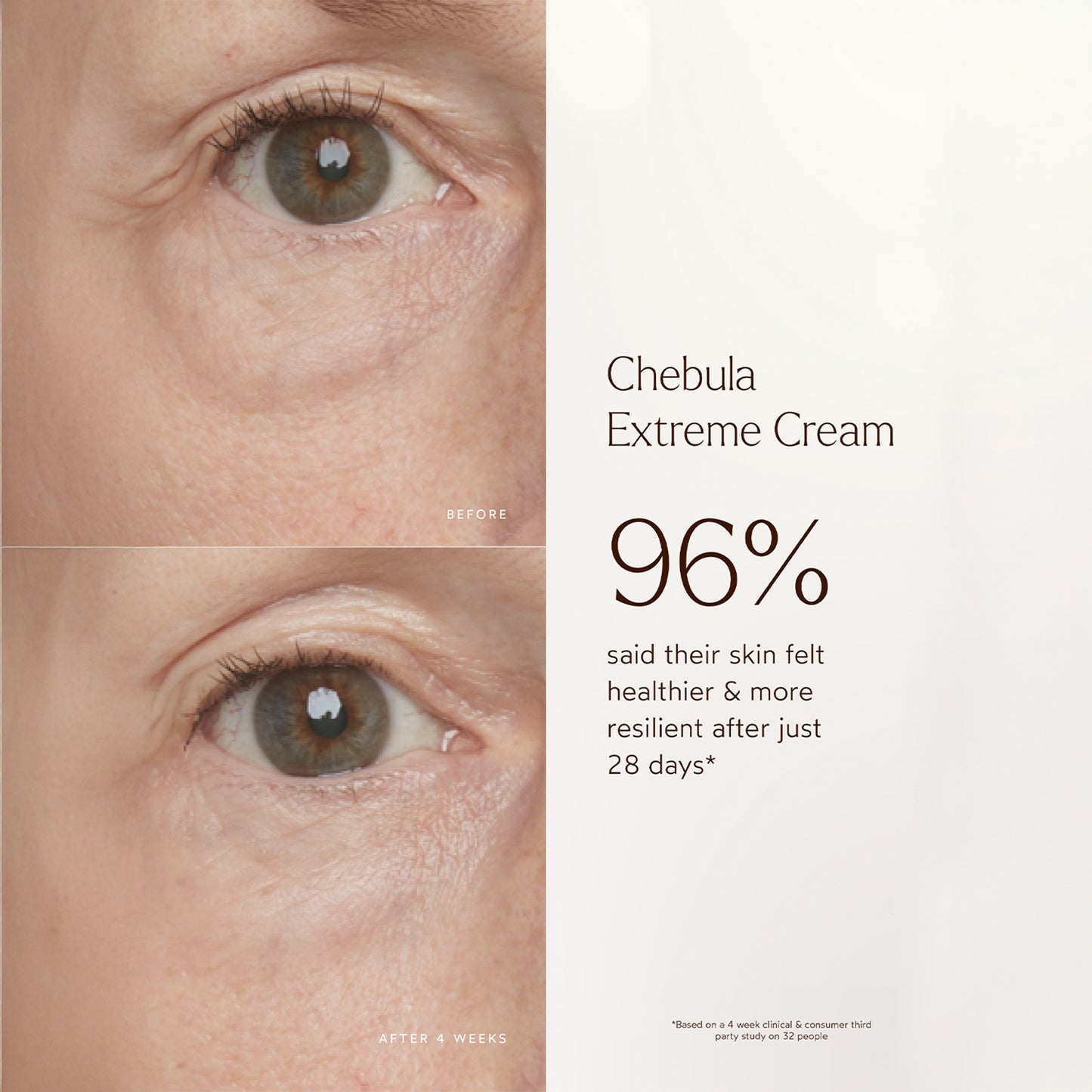 Chebula Extreme Cream