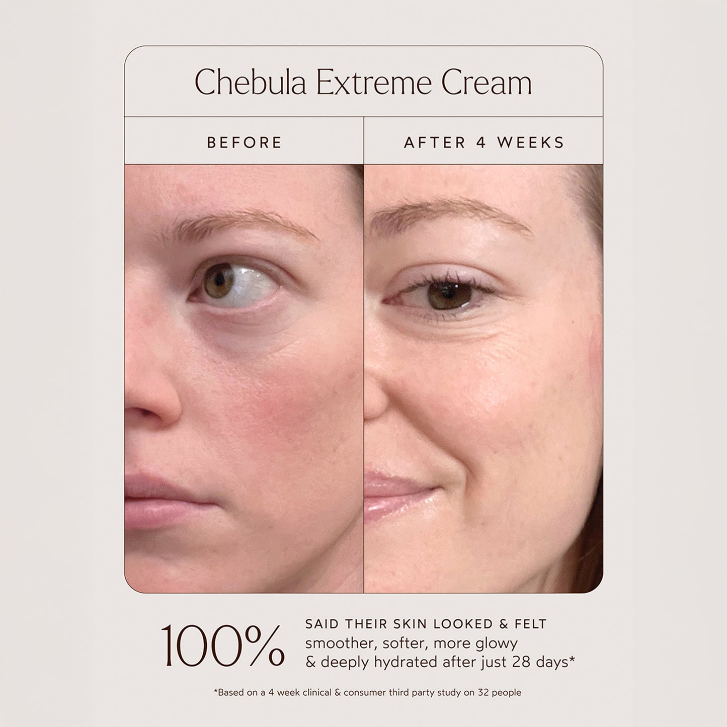 Chebula Extreme Cream
