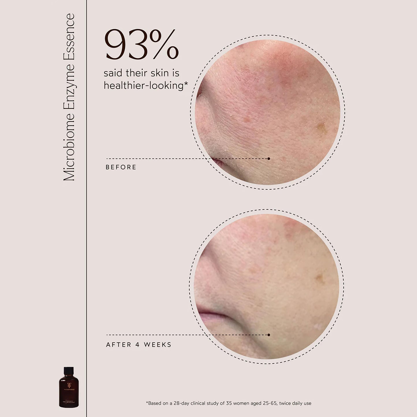 Microbiome Enzyme Essence