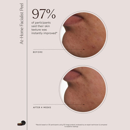 At-Home Facialist Peel