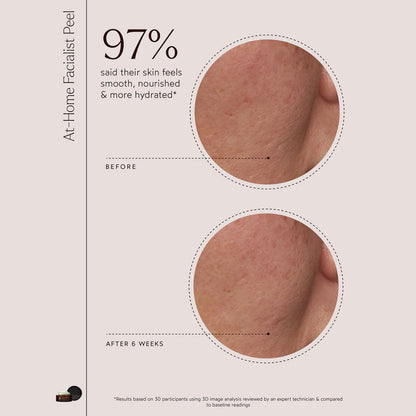 At-Home Facialist Peel