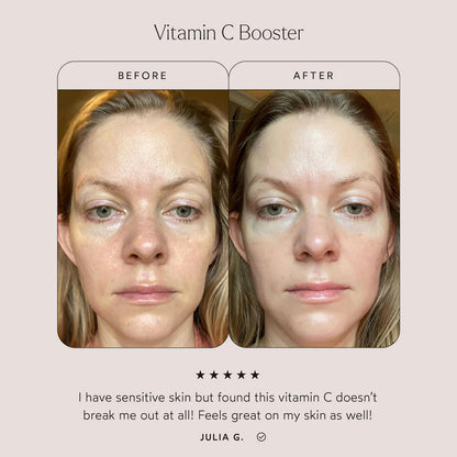 Vitamin C Booster