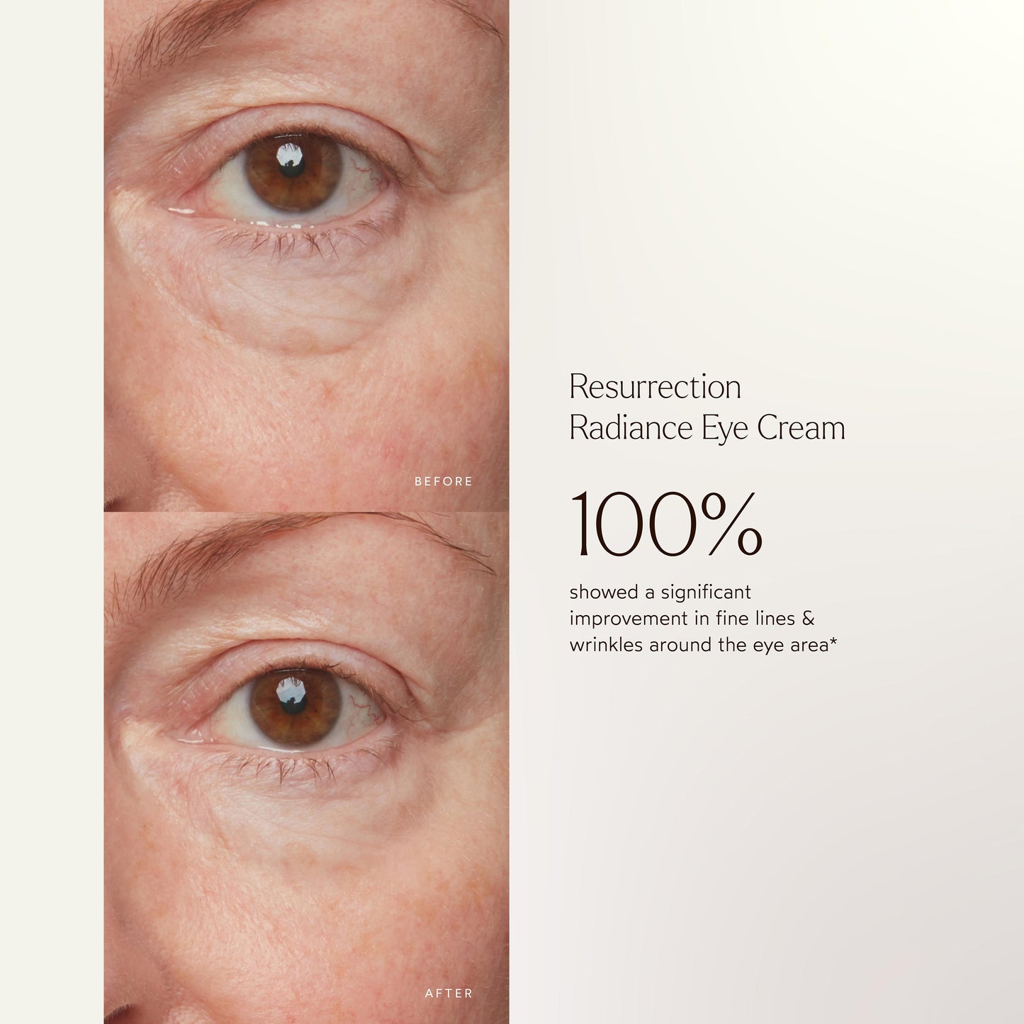 Renew Resurrection Radiance Eye Cream