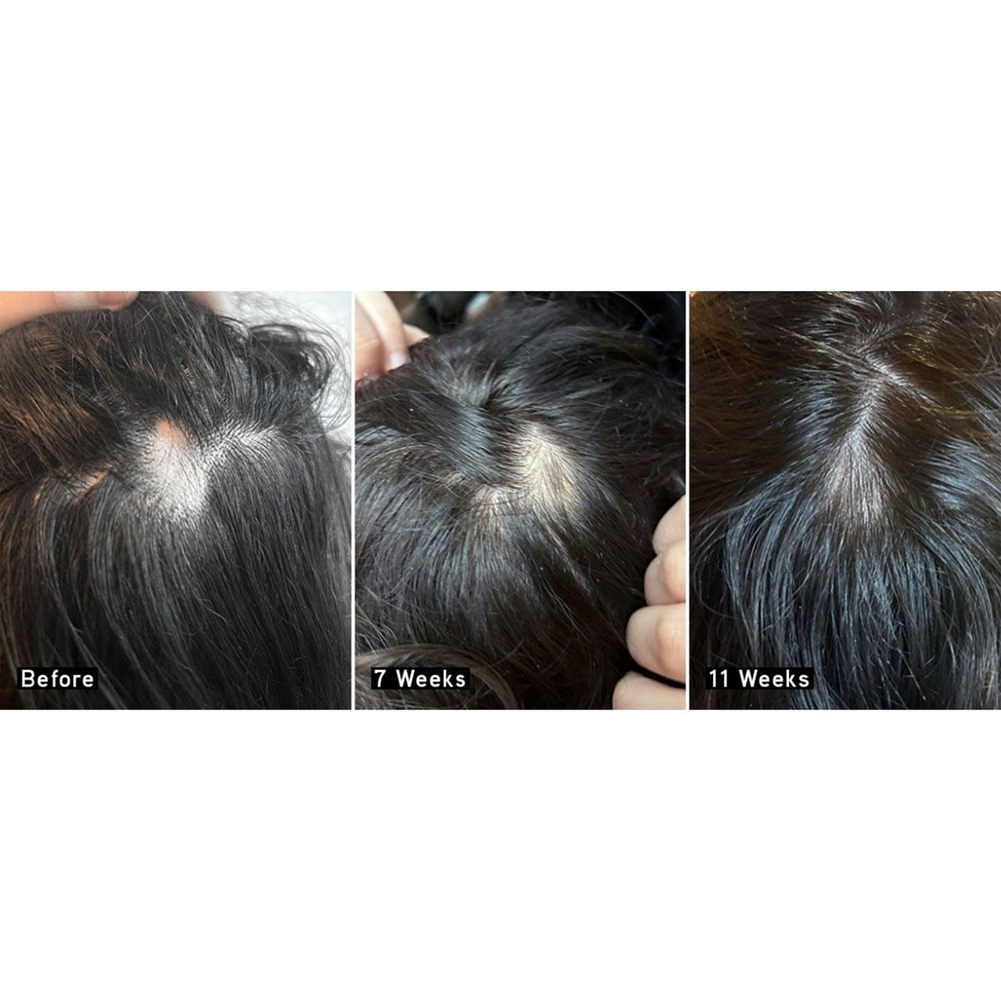 Scalp + Hair Rejuvenating Booster