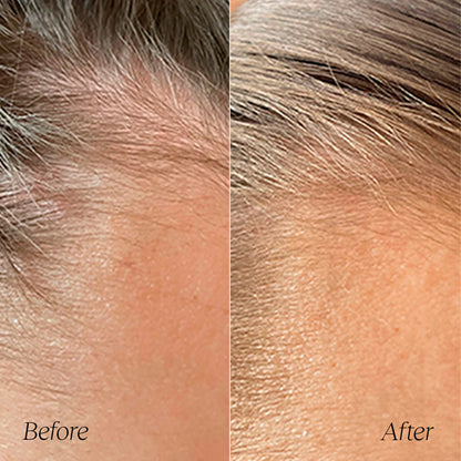 Follicle Boost Hair Density Serum