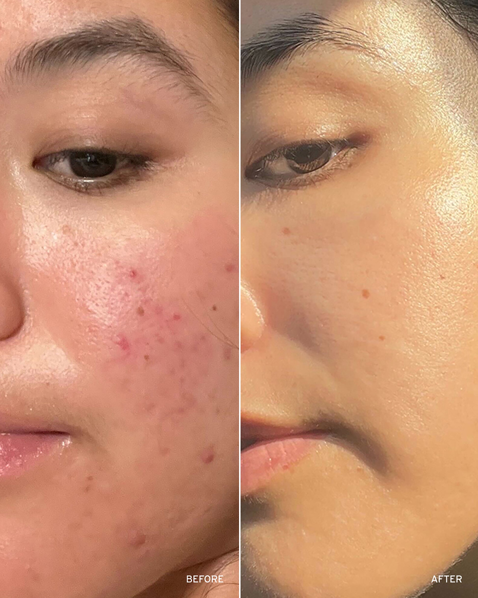 Retinol Peptide Boosting Serum
