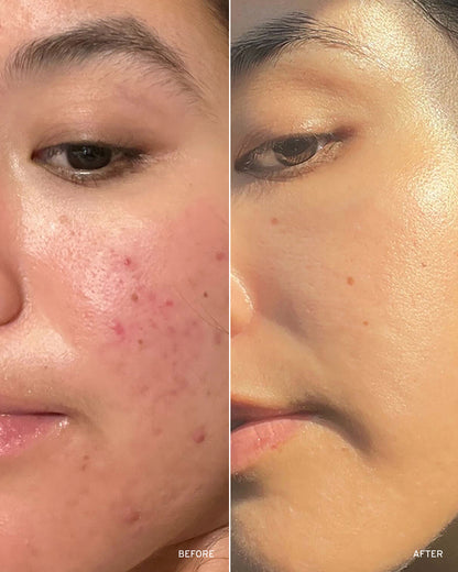 Retinol Peptide Boosting Serum
