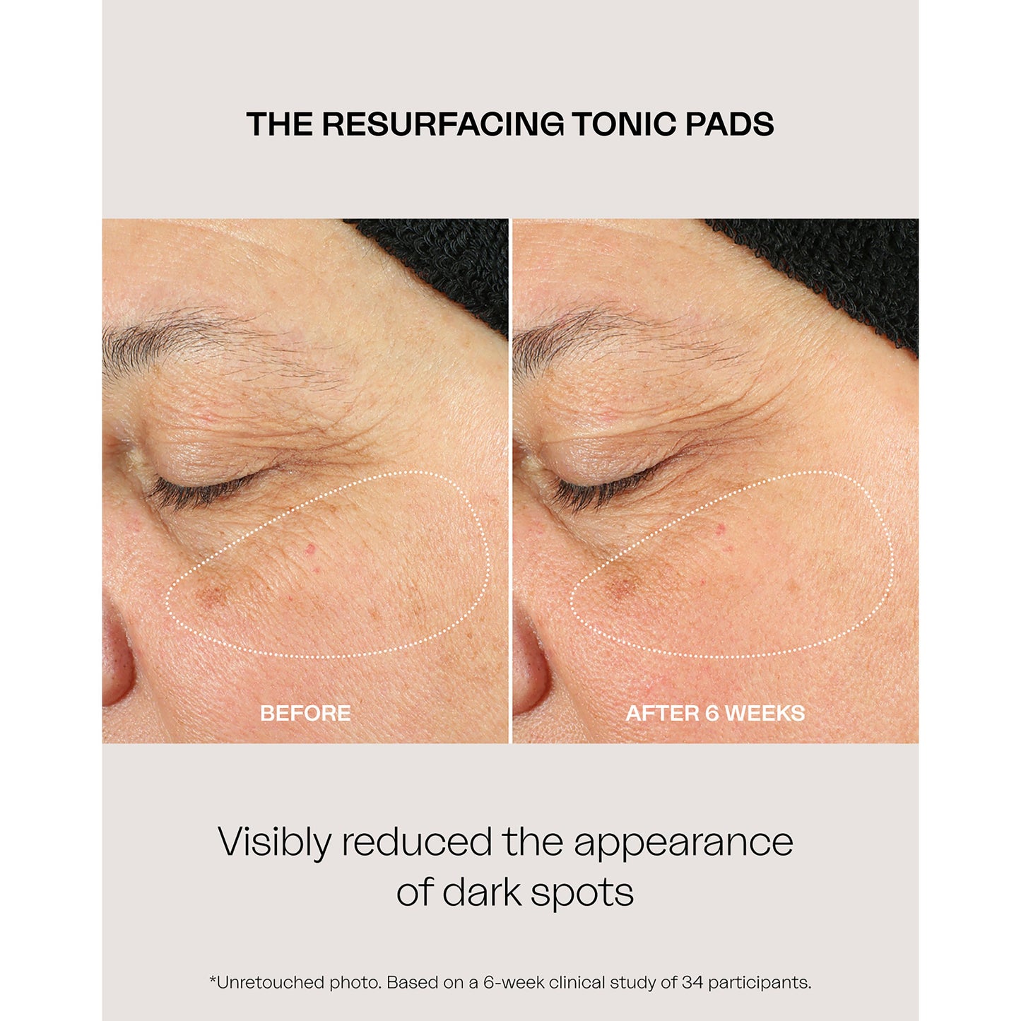 The Resurfacing Tonic Exfoliating Pads