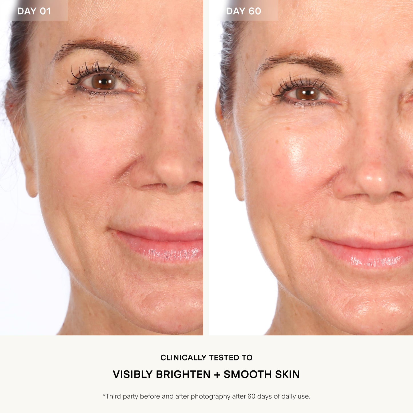 Resurfacing Flash Peel