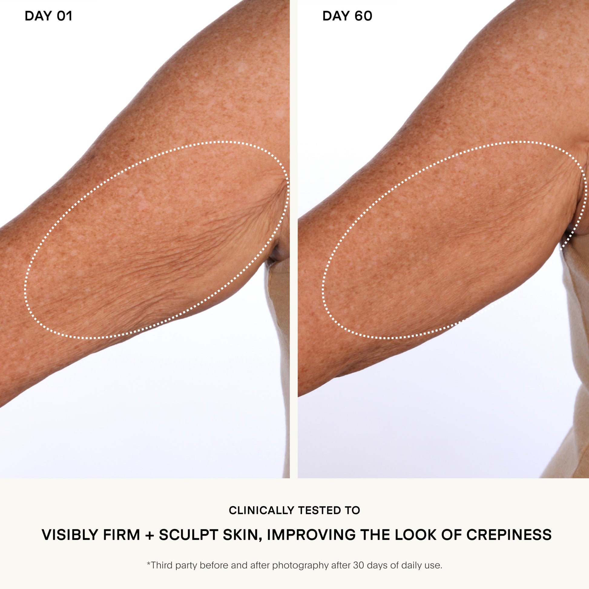 The SCULPT Arm Compound