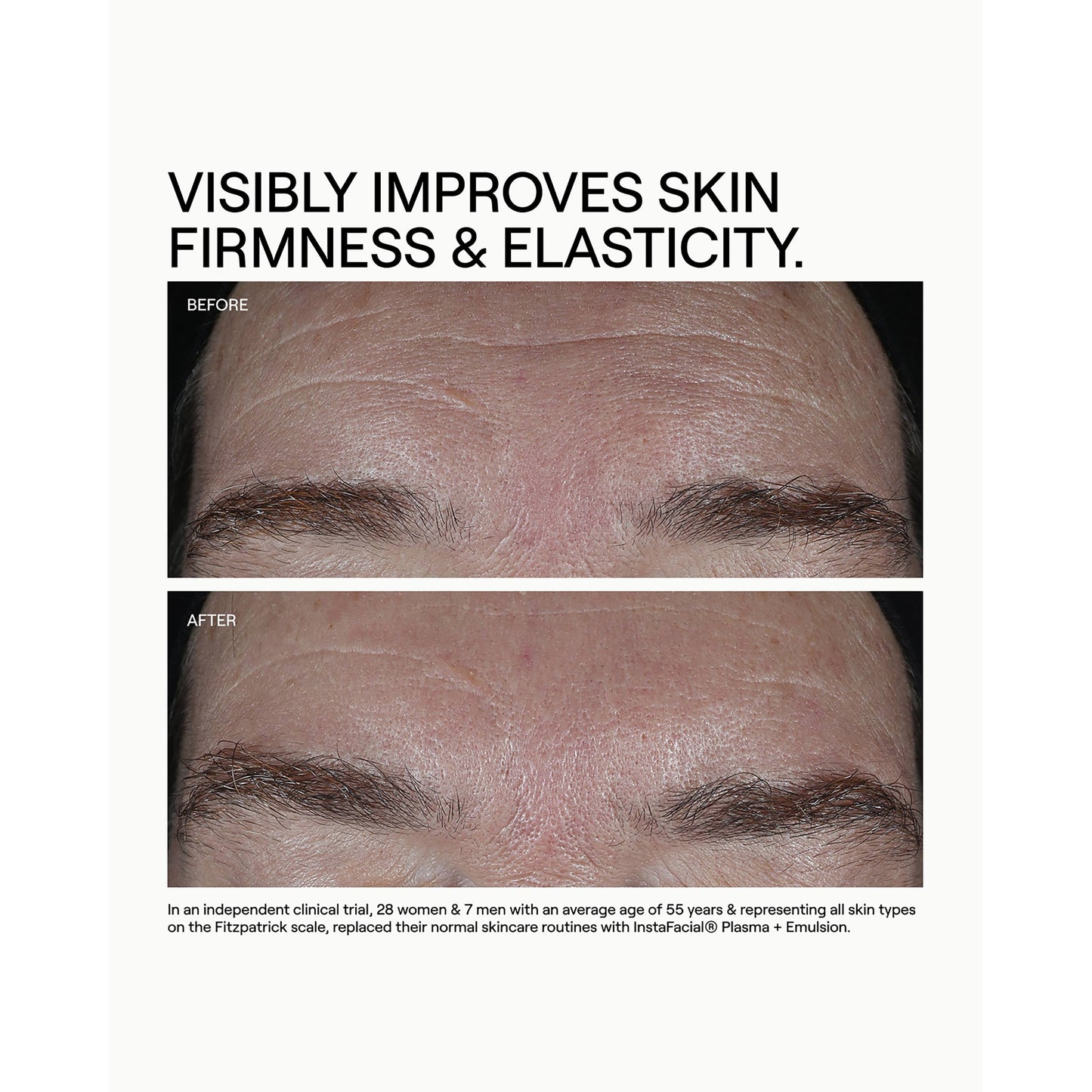 Instafacial Plasma Growth Factor Serum