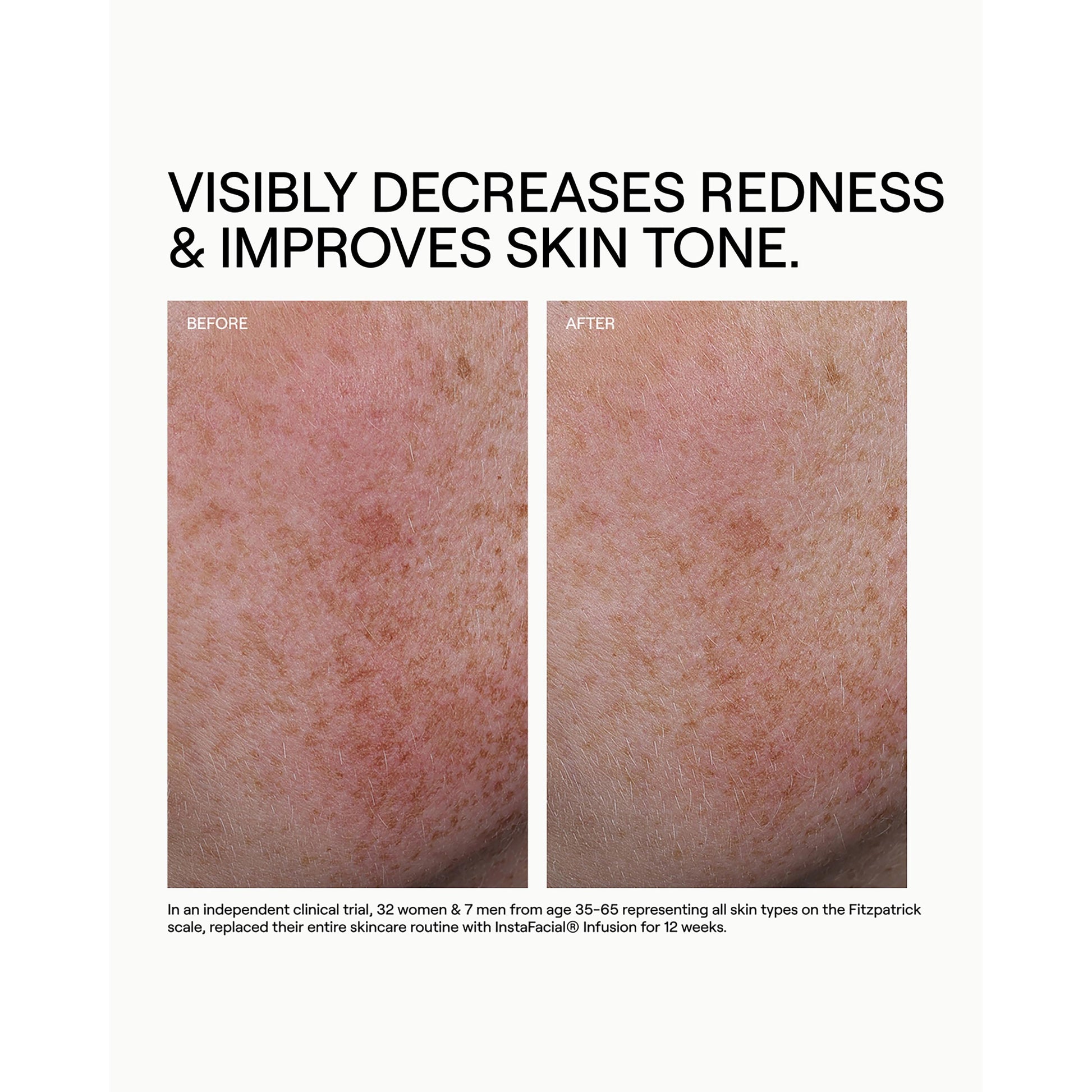 Hydr/O Bioactive Hydrolipid Barrier Moisturizer
