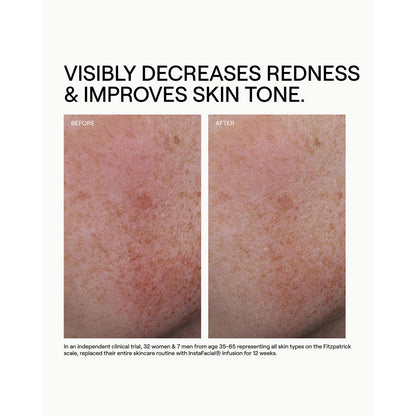 Hydr/O Bioactive Hydrolipid Barrier Moisturizer